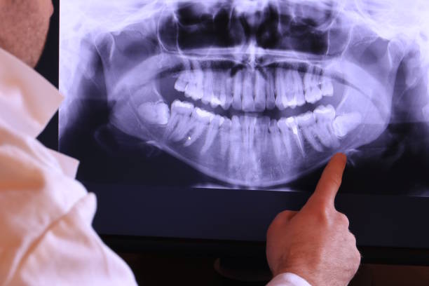 Best Emergency Root Canal Treatment in Matta, WA