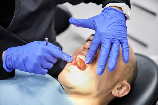 Best Emergency Treatment for Dental Infections or Abscesses in Matta, WA