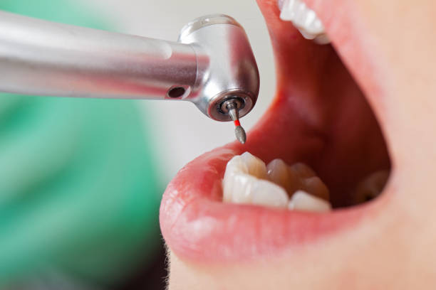 Best Emergency TMJ Treatment in Matta, WA